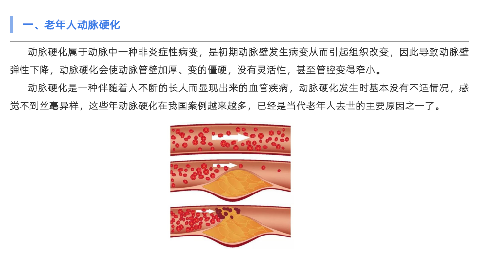 使用動(dòng)脈硬化檢測儀