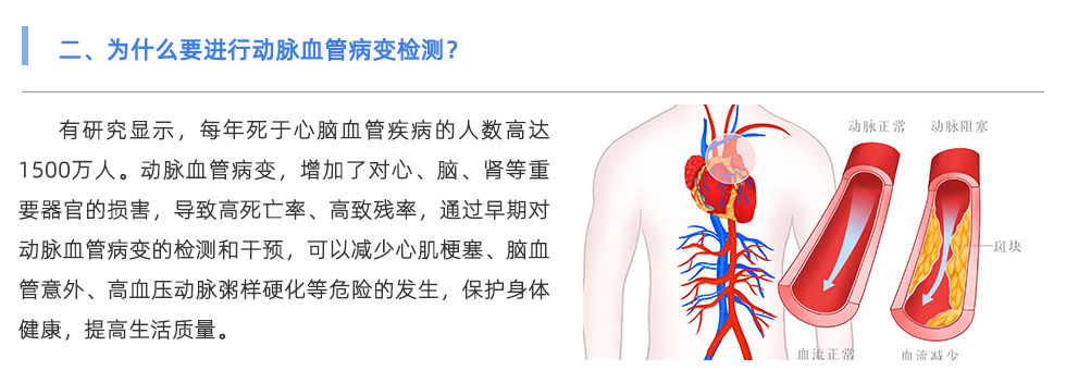 動脈硬化檢測儀