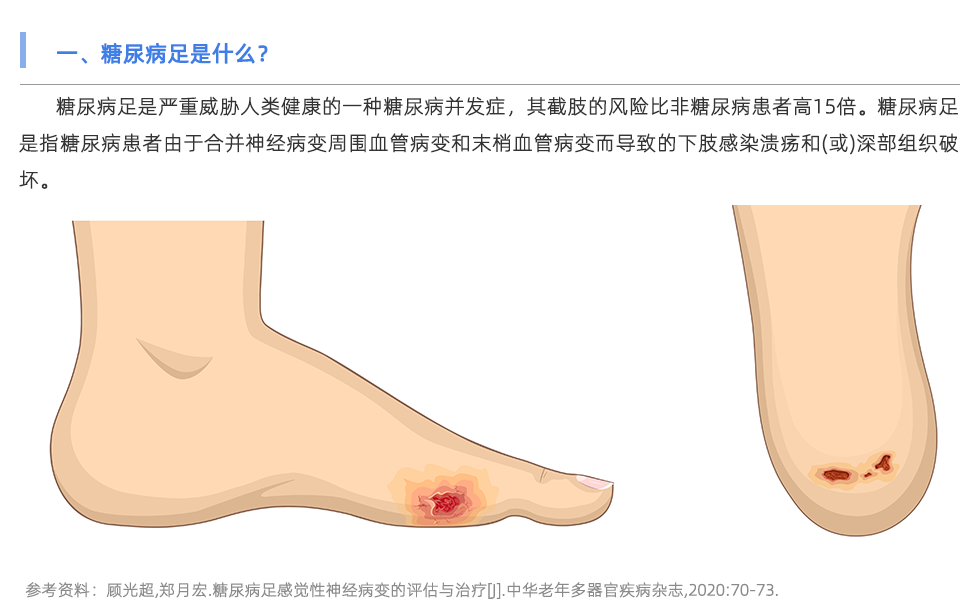 定制鞋墊