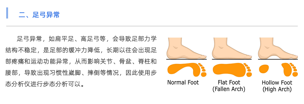 步態(tài)分析儀