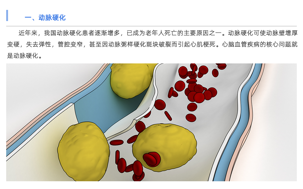 動脈硬化檢測儀