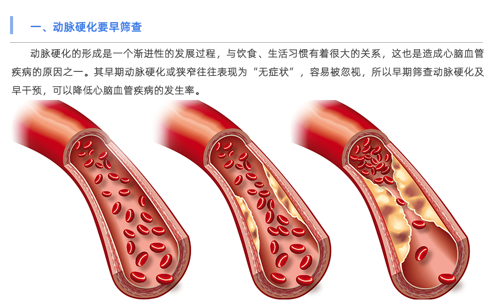 動(dòng)脈硬化檢測儀