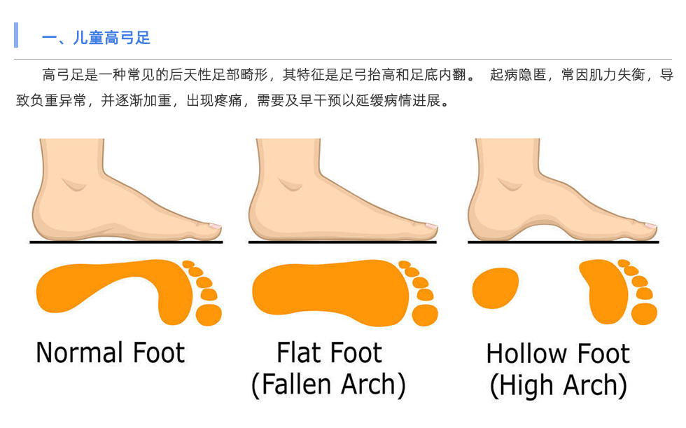 步態(tài)分析儀