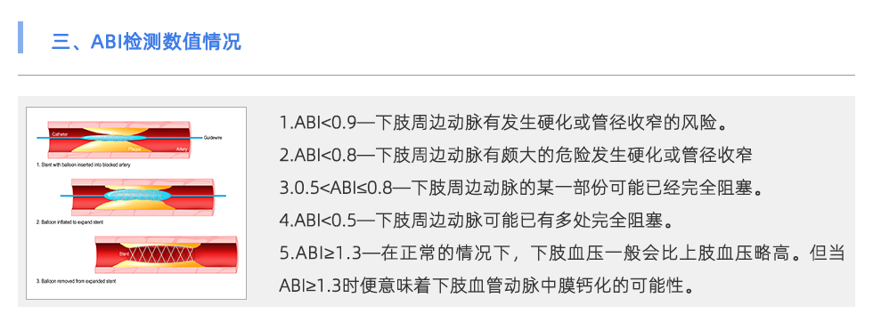 動(dòng)脈硬化檢測(cè)儀