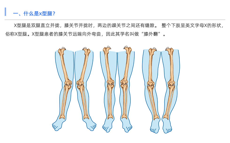 步態(tài)分析儀