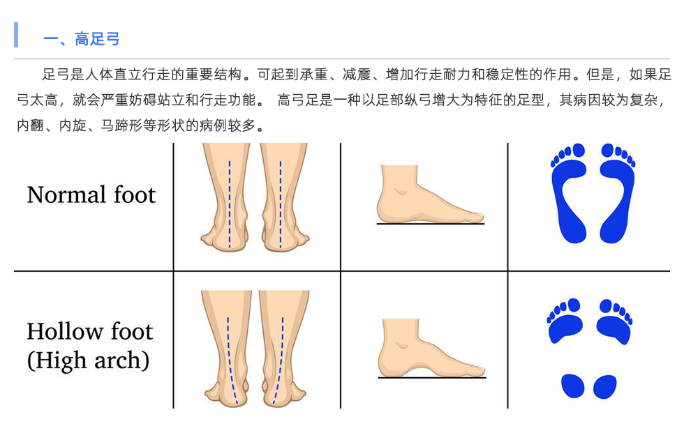 步態(tài)分析儀