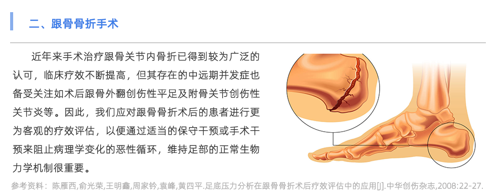 足底壓力分析系統(tǒng)