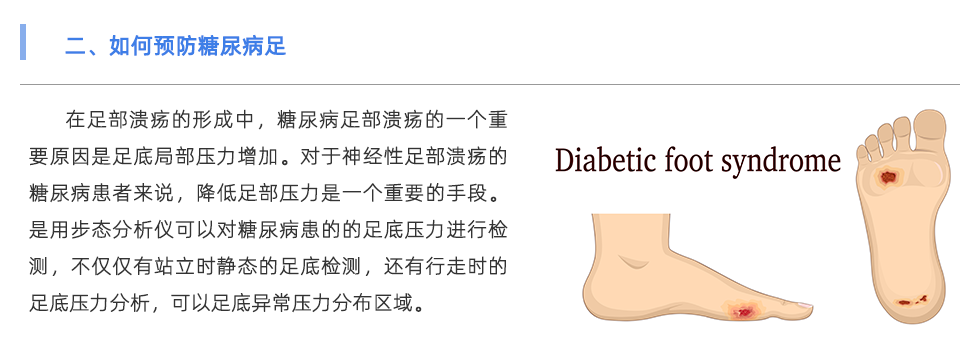 步態(tài)分析儀