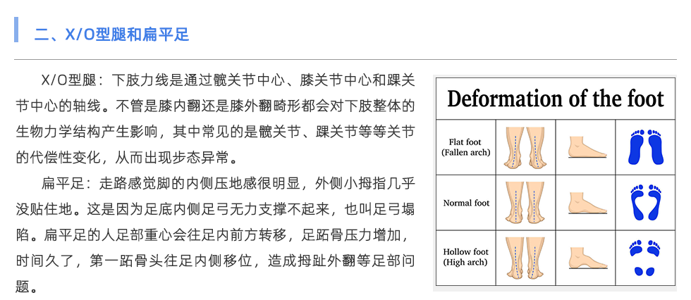 足底壓力分析系統(tǒng)