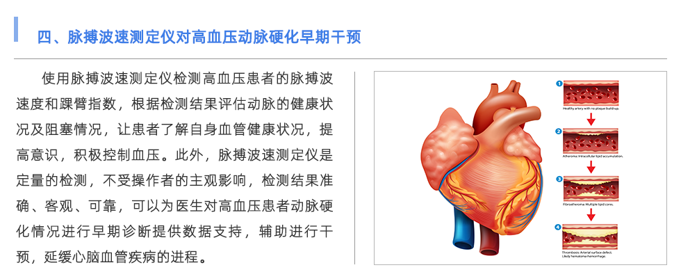 脈搏波速測定儀