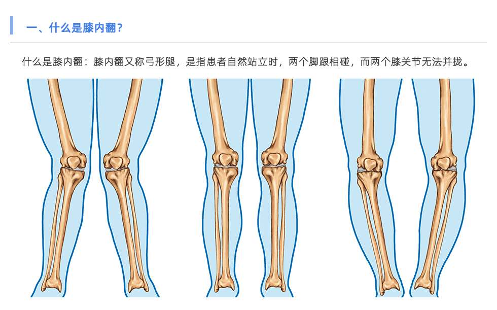 步態(tài)分析儀