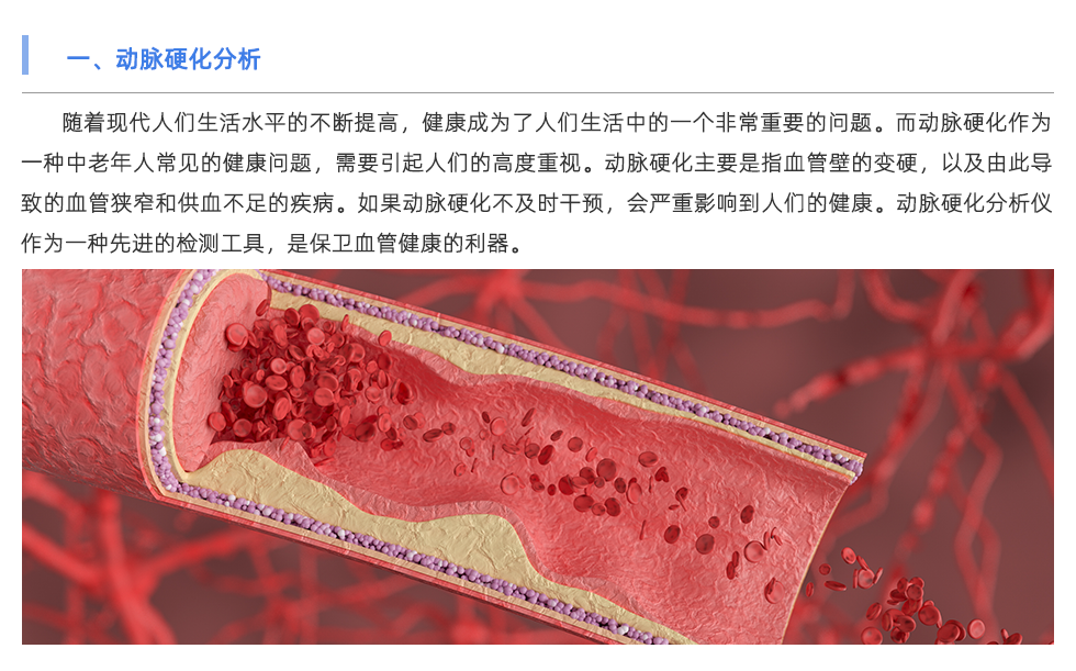 動(dòng)脈硬化分析儀