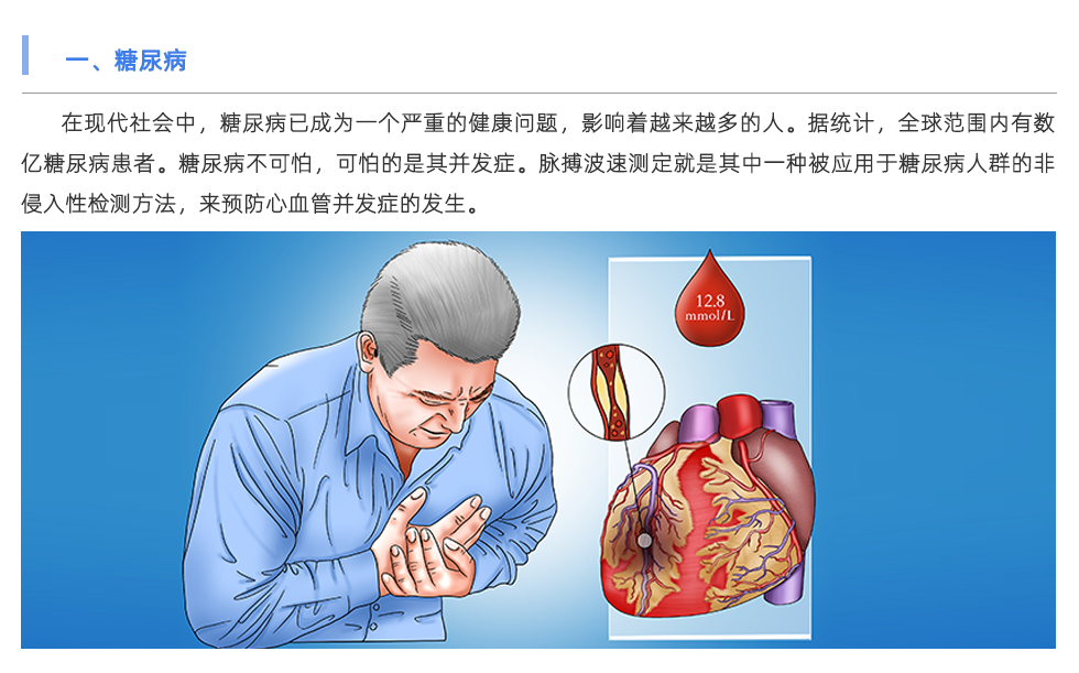 脈搏波速測(cè)定儀