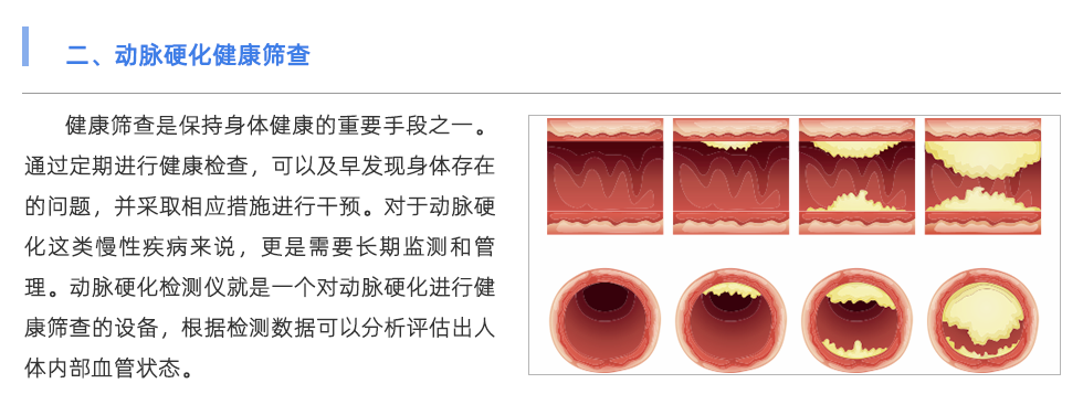 動脈硬化檢測儀