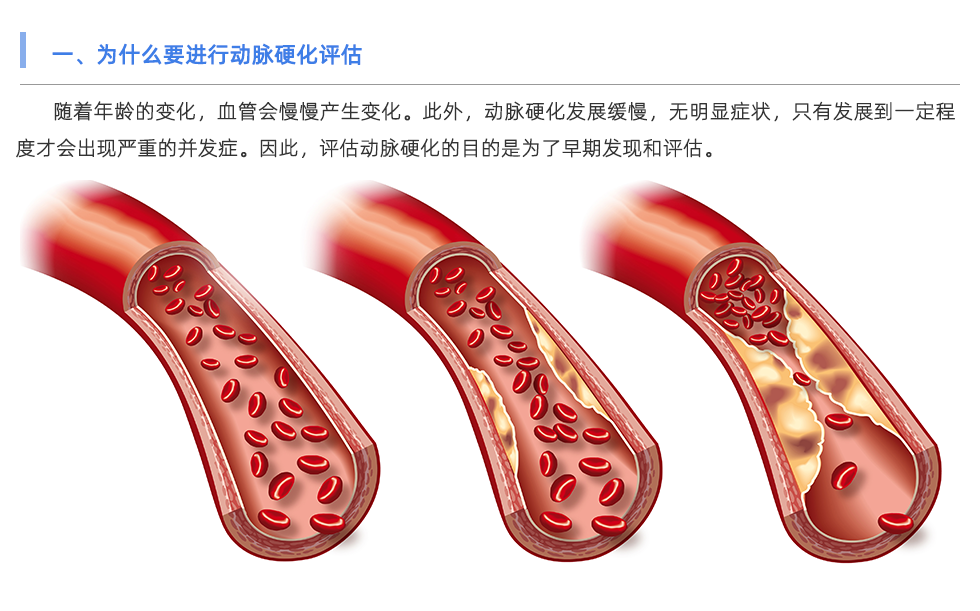 動脈硬化檢測儀