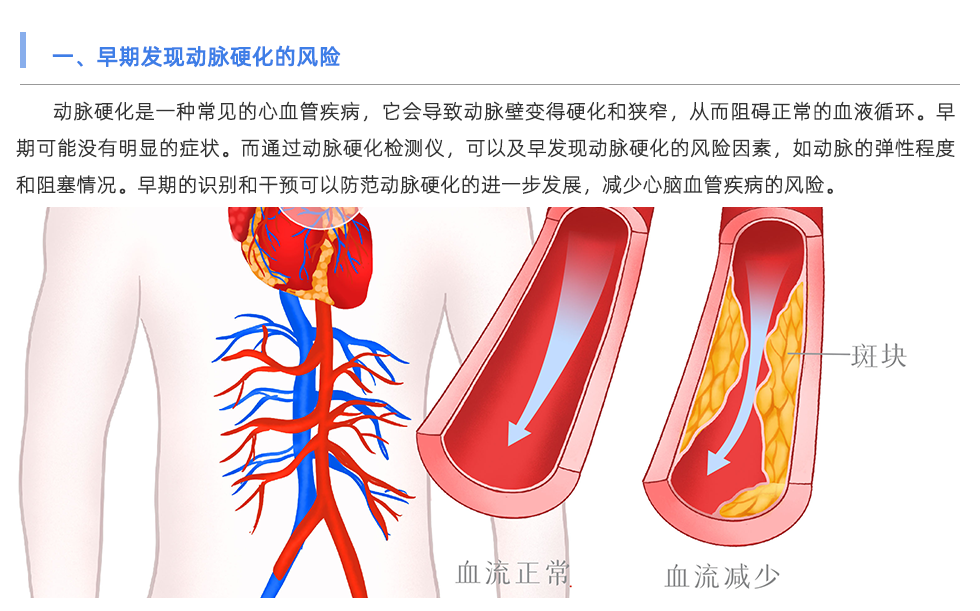 動脈硬化檢測儀