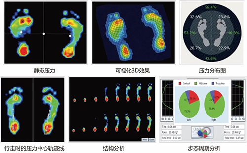 足底壓力分析系統(tǒng)